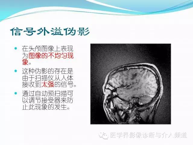 【PPT】磁共振常见伪影及对策