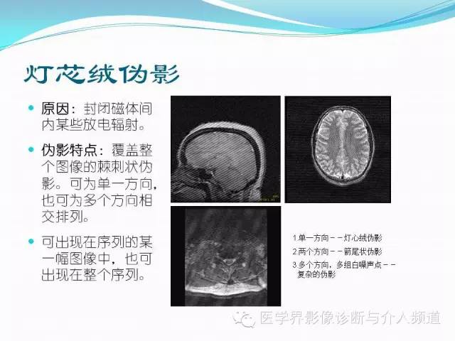 【PPT】磁共振常见伪影及对策