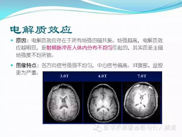 【PPT】磁共振常见伪影及对策