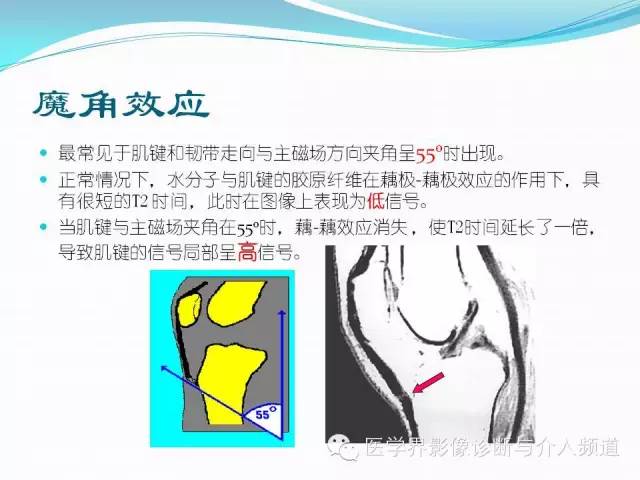 【PPT】磁共振常见伪影及对策