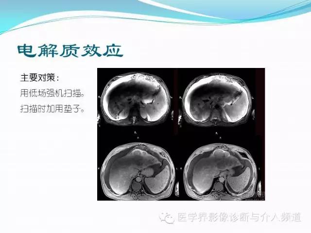 【PPT】磁共振常见伪影及对策