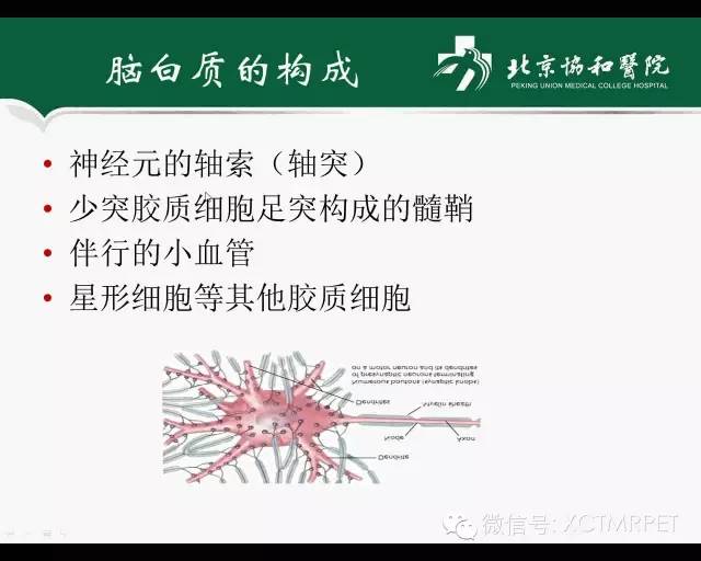 【PPT】炎性脱髓鞘疾病的MR诊断