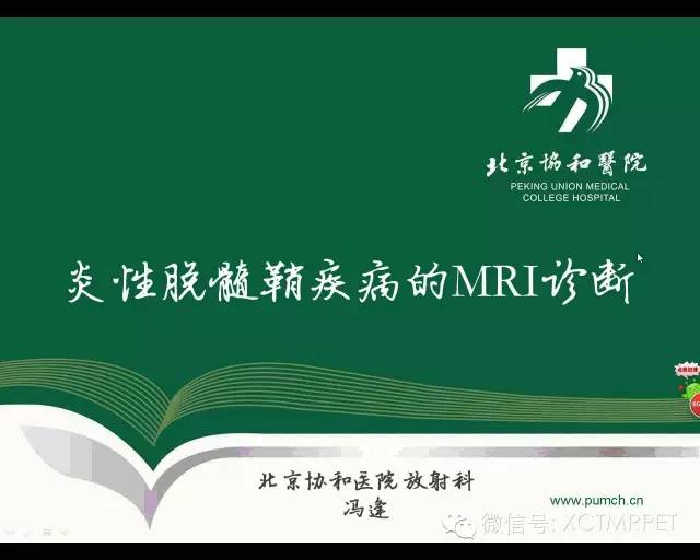 【PPT】炎性脱髓鞘疾病的MR诊断