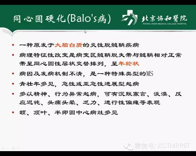 【PPT】炎性脱髓鞘疾病的MR诊断
