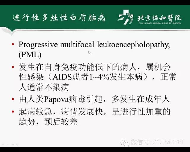 【PPT】炎性脱髓鞘疾病的MR诊断