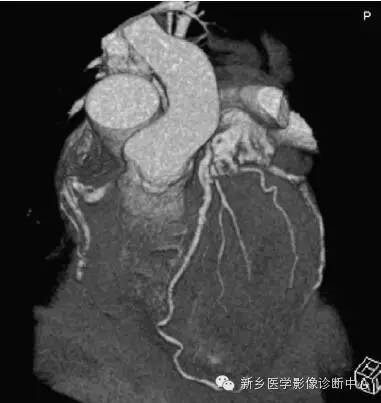 【病例】胸部血管（含冠脉）解剖+详细标注