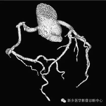 【病例】胸部血管（含冠脉）解剖+详细标注