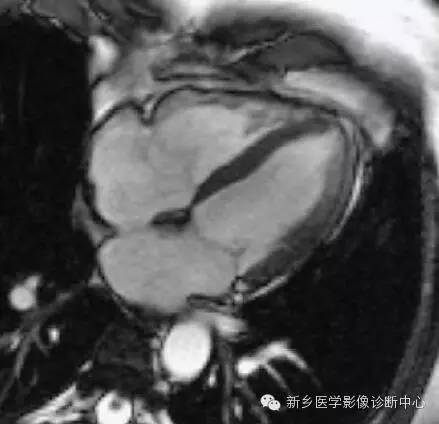 【病例】胸部血管（含冠脉）解剖+详细标注