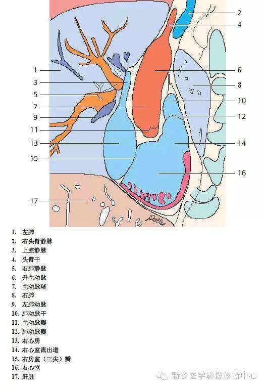 【病例】胸部血管（含冠脉）解剖+详细标注