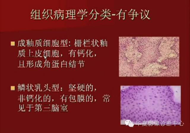 【PPT】下丘脑MR影像诊断