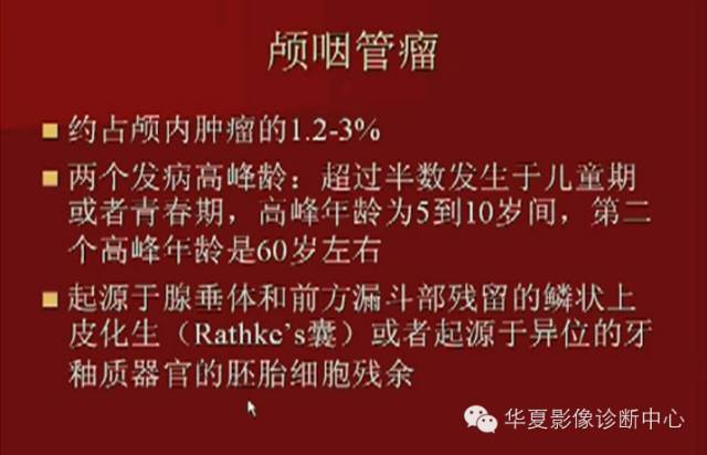【PPT】下丘脑MR影像诊断