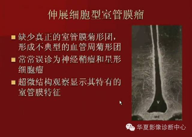 【PPT】下丘脑MR影像诊断