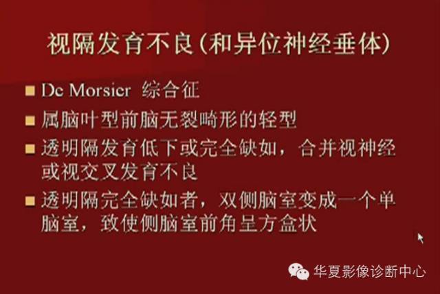 【PPT】下丘脑MR影像诊断