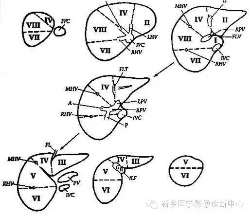 腹部横断位解剖+详细标注+肝脏分段