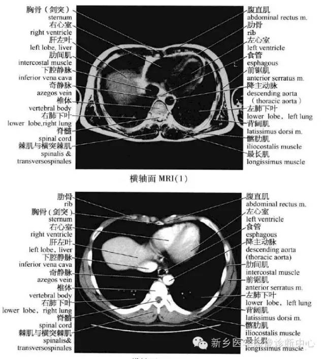 腹部横断位解剖+详细标注+肝脏分段