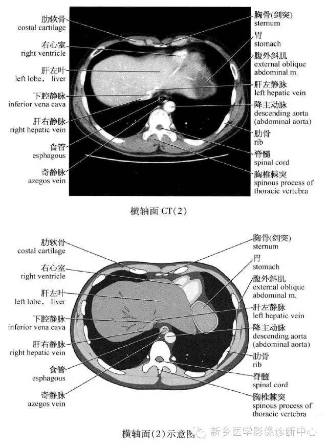 腹部横断位解剖+详细标注+肝脏分段