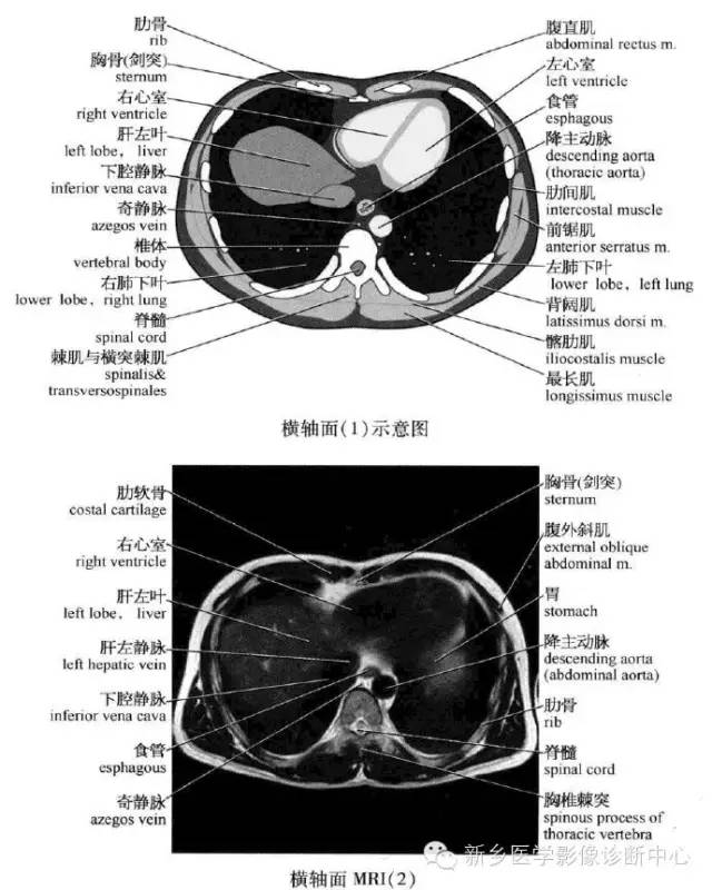 腹部横断位解剖+详细标注+肝脏分段