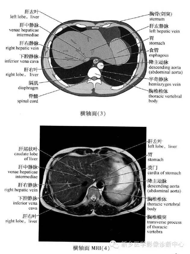 腹部横断位解剖+详细标注+肝脏分段
