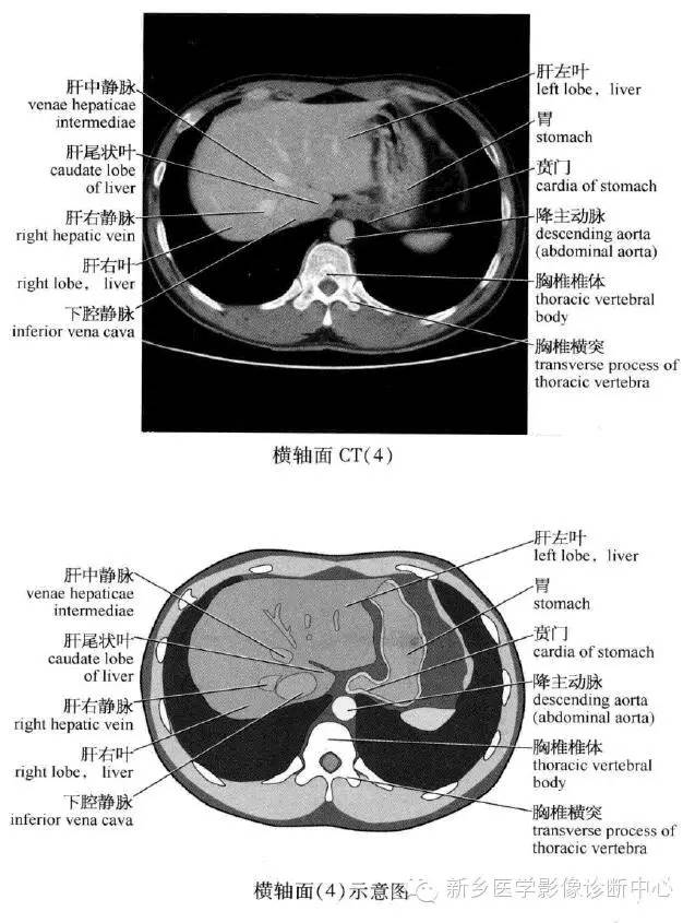 腹部横断位解剖+详细标注+肝脏分段