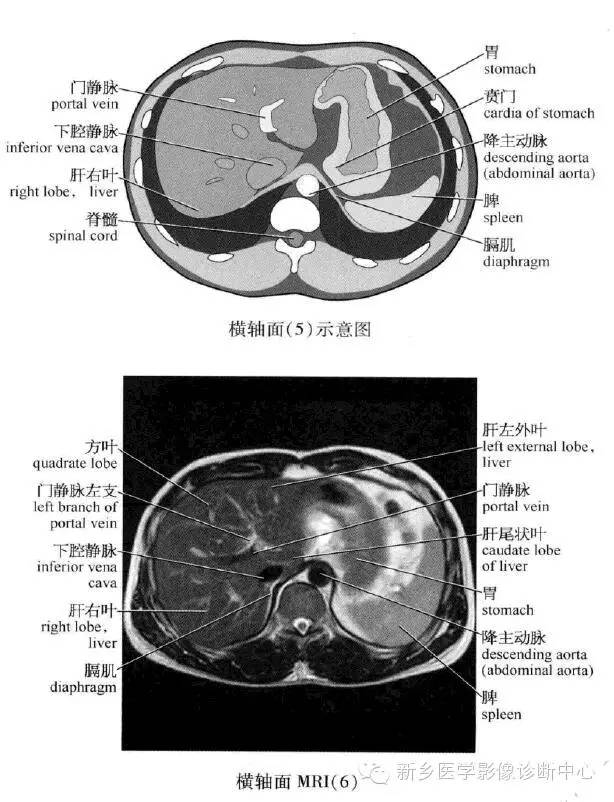 腹部横断位解剖+详细标注+肝脏分段