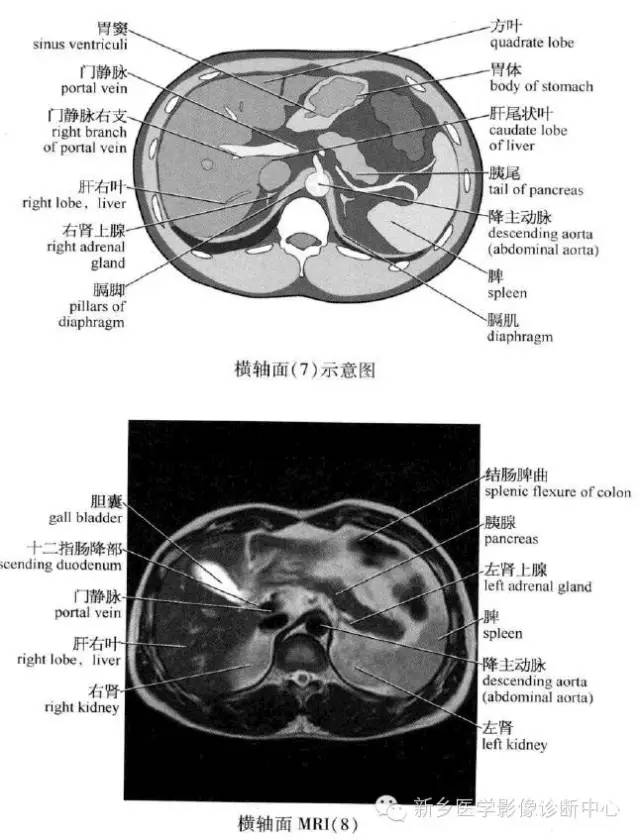 腹部横断位解剖+详细标注+肝脏分段