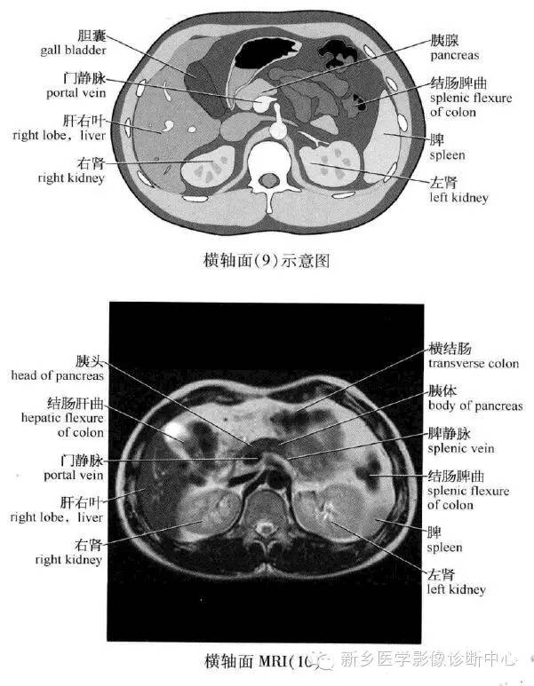 腹部横断位解剖+详细标注+肝脏分段