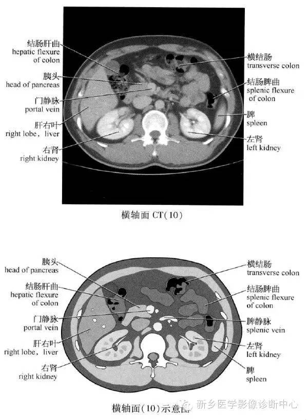 腹部横断位解剖+详细标注+肝脏分段