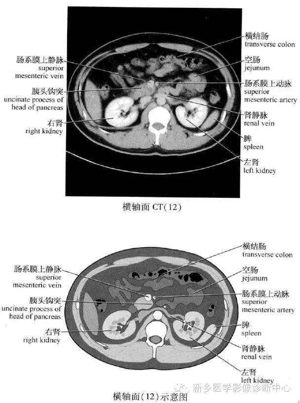 腹部横断位解剖+详细标注+肝脏分段