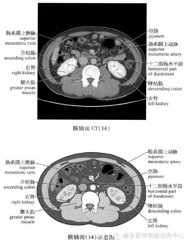 腹部横断位解剖+详细标注+肝脏分段