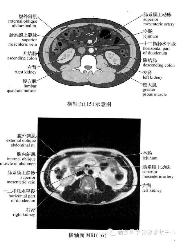 腹部横断位解剖+详细标注+肝脏分段
