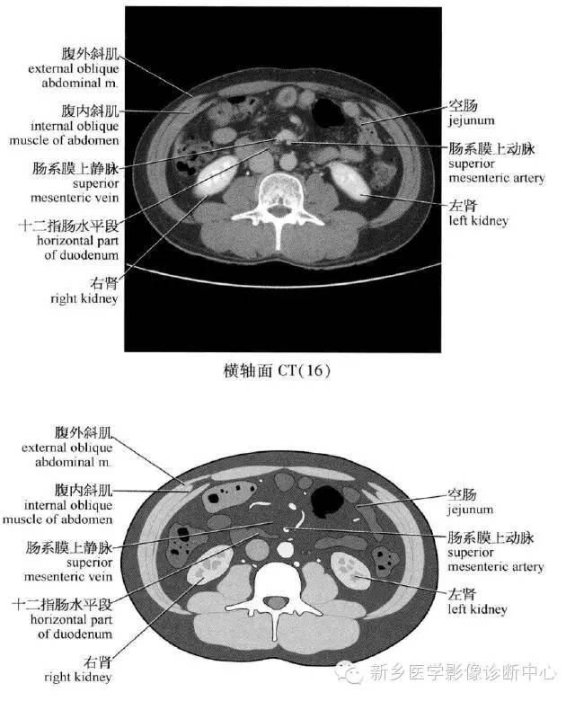 腹部横断位解剖+详细标注+肝脏分段