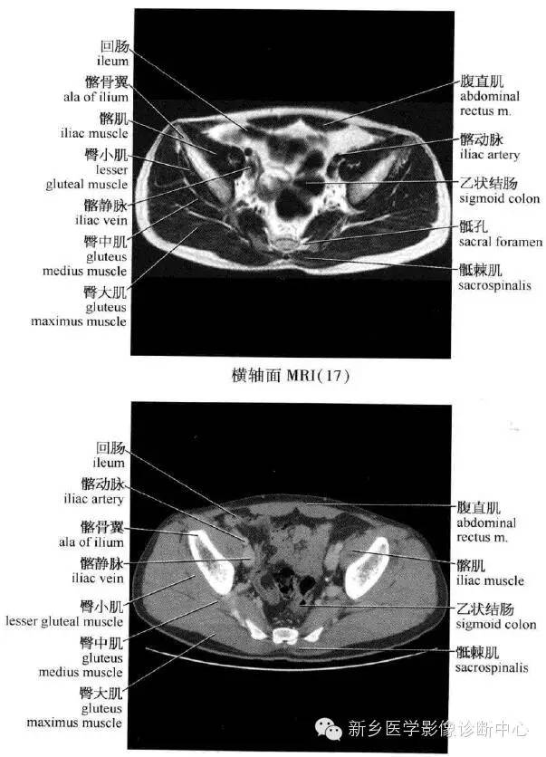 腹部横断位解剖+详细标注+肝脏分段
