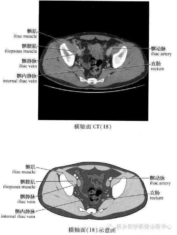 腹部横断位解剖+详细标注+肝脏分段