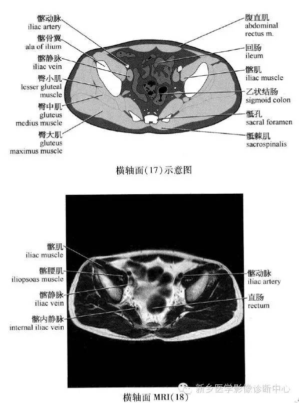 腹部横断位解剖+详细标注+肝脏分段