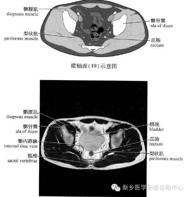 腹部横断位解剖+详细标注+肝脏分段