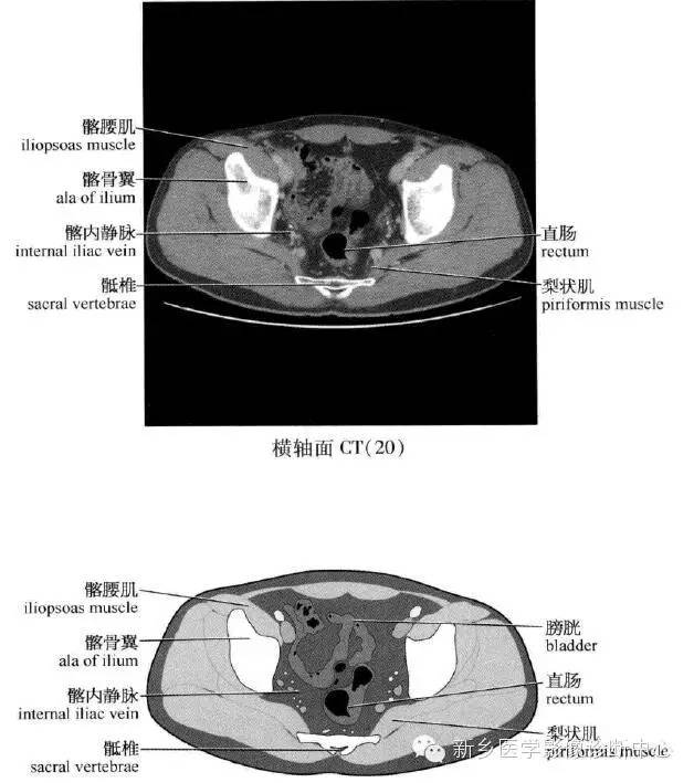 腹部横断位解剖+详细标注+肝脏分段