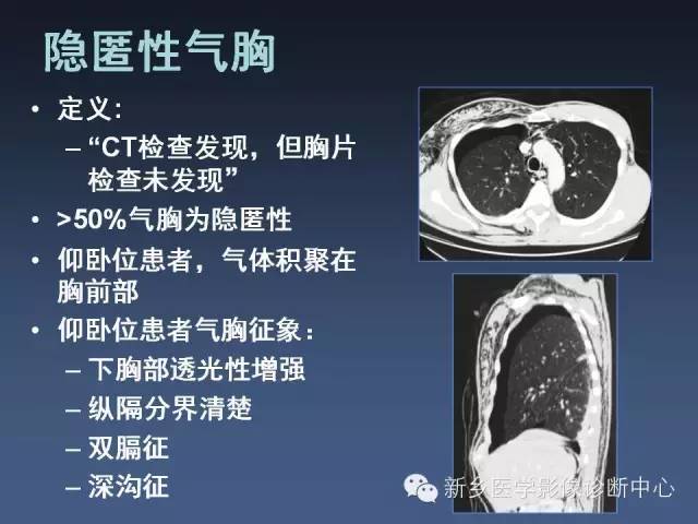 多层螺旋CT（MDCT）在胸部外伤诊断中的应用
