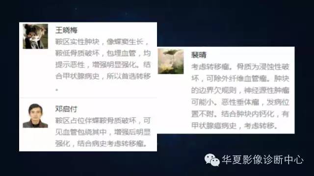 【病例】蝶窦甲状腺转移瘤1例CT MR影像表现