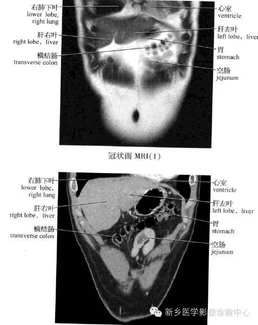 腹部冠状位解剖+详细标注