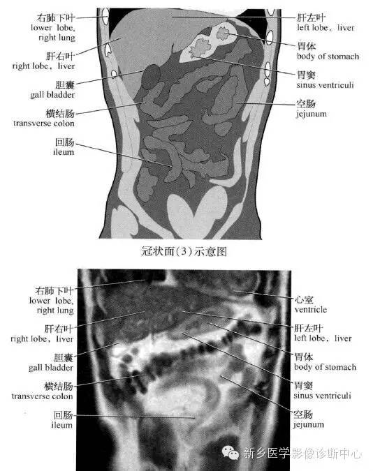 腹部冠状位解剖+详细标注