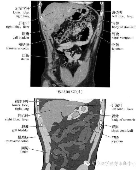 腹部冠状位解剖+详细标注