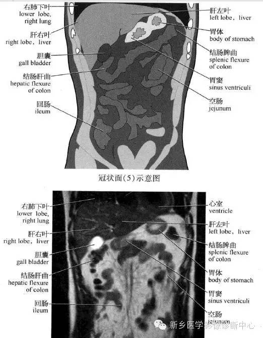 腹部冠状位解剖+详细标注