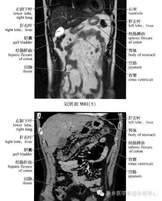 腹部冠状位解剖+详细标注