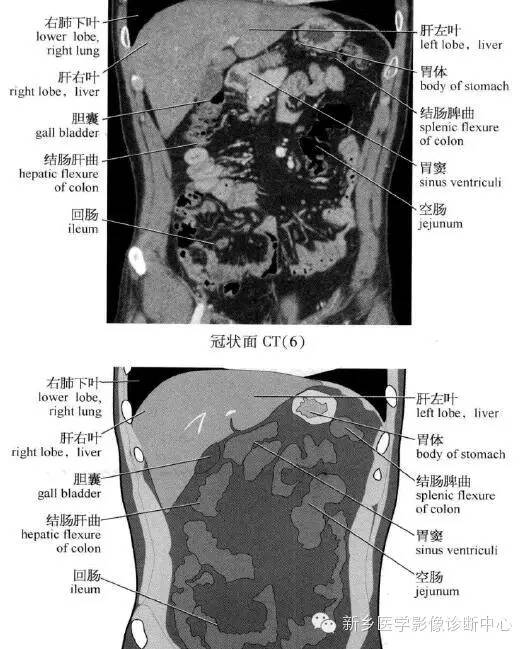 腹部冠状位解剖+详细标注