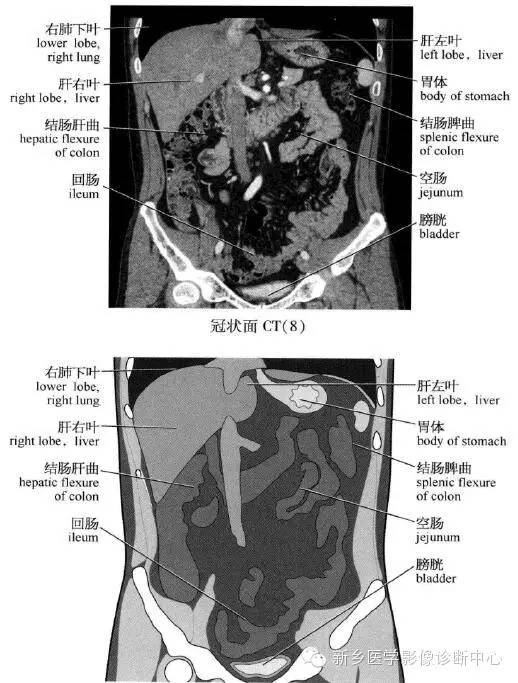 腹部冠状位解剖+详细标注