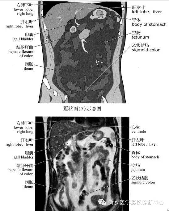 腹部冠状位解剖+详细标注