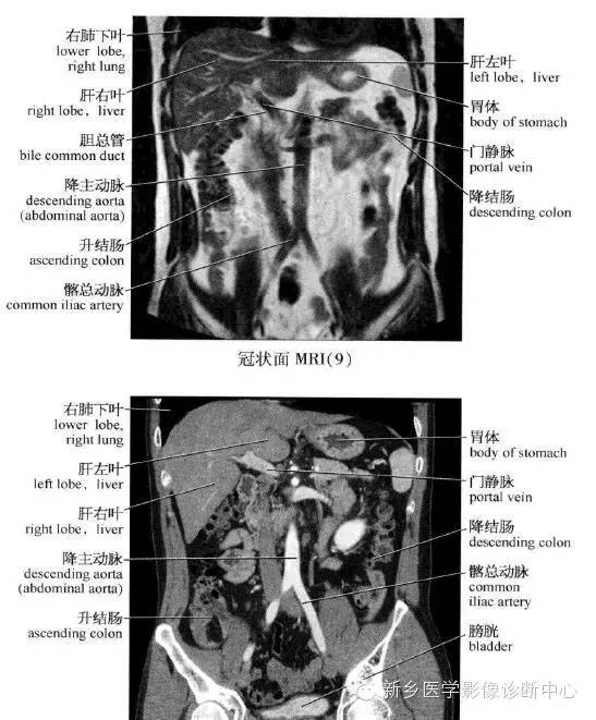 腹部冠状位解剖+详细标注