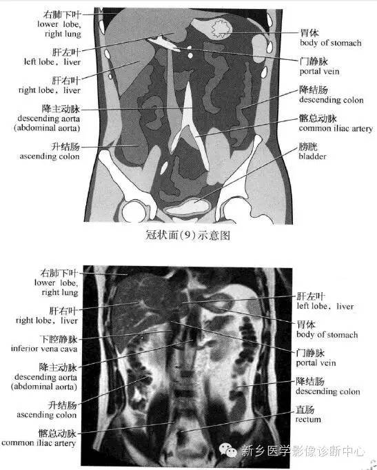 腹部冠状位解剖+详细标注