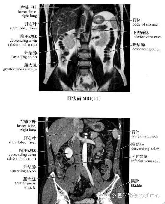 腹部冠状位解剖+详细标注