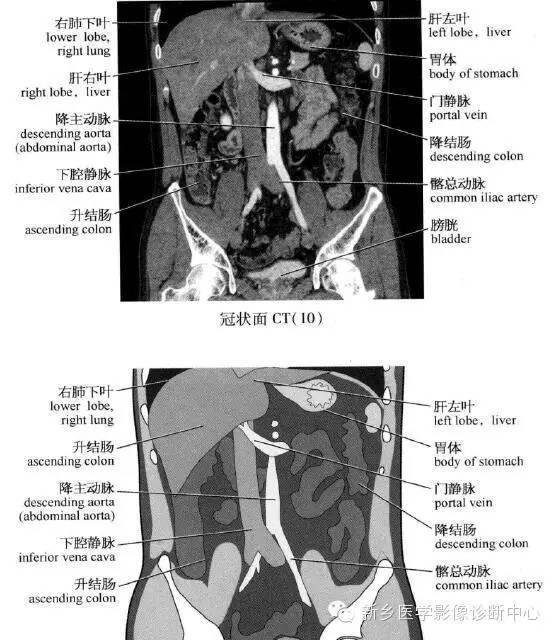 腹部冠状位解剖+详细标注